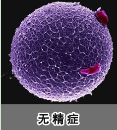 哪些因素会引发无精症